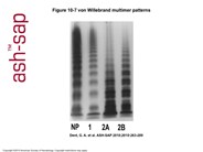 von Willebrand multimer patterns
