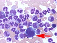 Megakaryocytic maturation - 1.