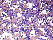 Increased M:E ratio - 1.