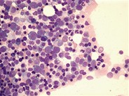 Inverted M:E ratio - 1.