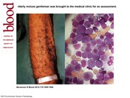 Wouldn't have happened to a Limey