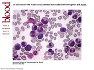 False normal vitamin B12 levels caused by assay error