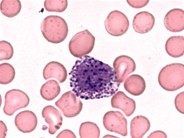 Basophil - 1.