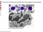 Giant parallel tubular arrays in T lymphocytes