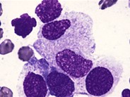 Extrinsic cells - 1.