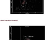 Acute Biphenotypic Leukemia - 6.