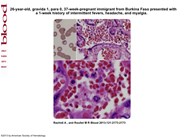 Malaria during pregnancy with parasite sequestration in the villous chamber