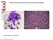 Touch imprint matters…