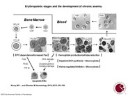 Erythropoietic stages and the development of chronic anemia