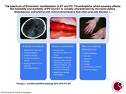 The spectrum of thrombotic manifestation in ET and PV.