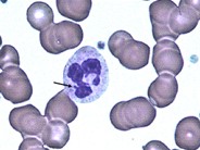 Neutrophil - Nuclear Appendages - 2.