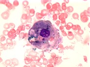 Histiocyte - 1.