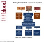 Pathway for a patient with suspected AL amyloidosis