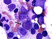Eosinophilic Precursors - 1.