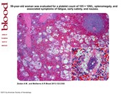 Lipogranulomatosis and hypersplenism induced by ruptured silicone breast implants