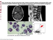 Leptomeningeal metastases from primary plasma cell leukemia