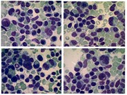 Phagocytic plasma cells