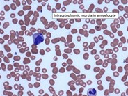 Anaplasma morulae detected on peripheral smear
