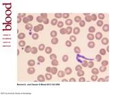 Circulating proplatelet