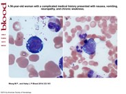 An unusual cause of anemia