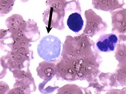 Pseudothrombocyte - 1.