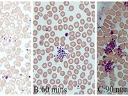 platelet clumps significantly with time gone
