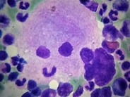 Smiley Megacaryocyte