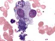 Platelet Formation - 1.