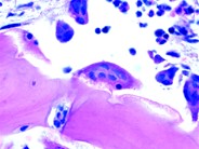Osteoclast - 1.