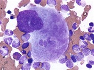 Emperipolesis in megakaryocyte - 1.