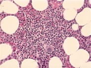 Normal adult bone marrow – trephine biopsy - 2.