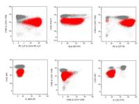 Acute-undifferentiated-leukemiaFlow-cytometry