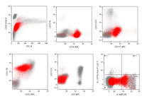 Acute-myeloid-leukemia-with-myelodysplasia-related-changes-flow