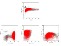 Acute-myeloid-leukemia-with-the-t821q2222-Flow-cytometry