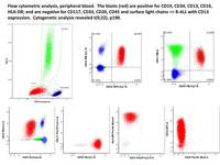 ALL-Ph-CD-13-positive-flow-cytometry