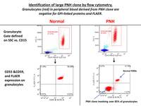 Paroxysmal-nocturnal-hemoglobinuria-PNH-Flow-Cytometry