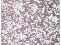 Red cell agglutination