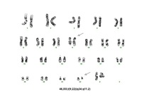 Cytogenetics-ALL-Ph