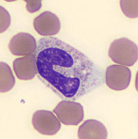 Band neutrophil