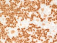 Pax5-staining-on-HRS-cells