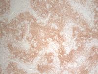 CD21-marks-dendritic-meshworks