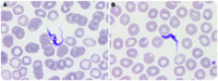 Human African trypanosomiasis diagnosis by peripheral blood smear review in a Spanish traveler