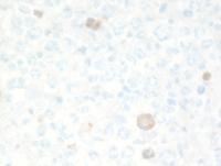 GZL-CD30-IHC