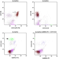 CD10-Tcells-in-AITL