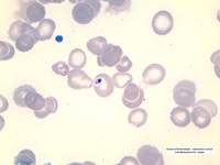Leishmania bodies
