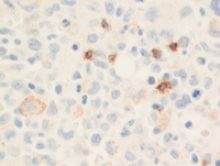 Tryptase-IHC