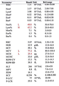 Haemoglobin D (CBC)