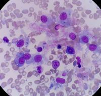 Histiocytes in normal bone marrow
