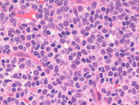 Plasmacytoid dendritic cells (PDC)