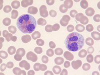 Eosinophils